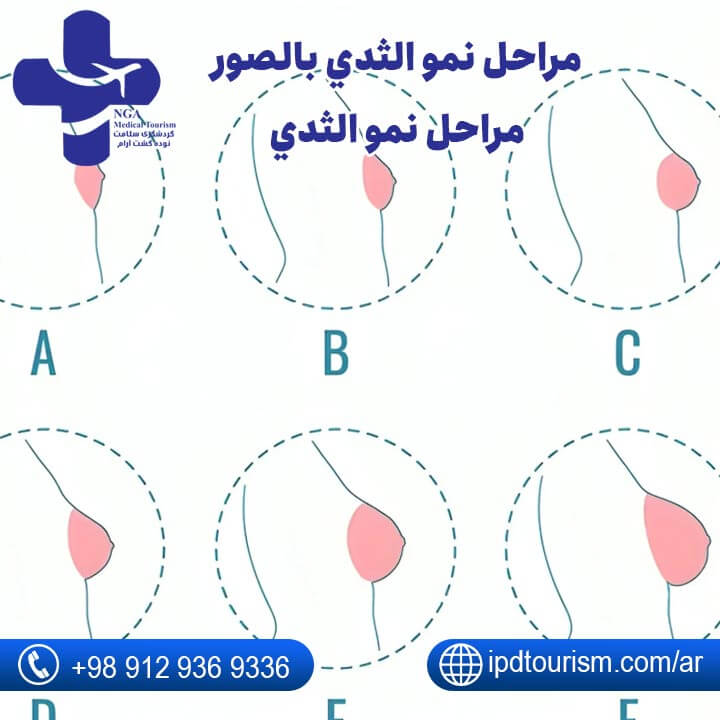 تكبير الثدي-7