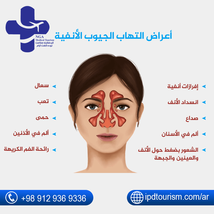 اعراض-التهاب-الجيوب-الأنفية