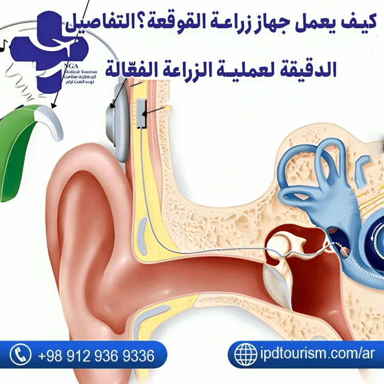 كيف يعمل جهاز زراعة القوقعة؟التفاصيل الدقيقة لعملية الزراعة الفعّالة