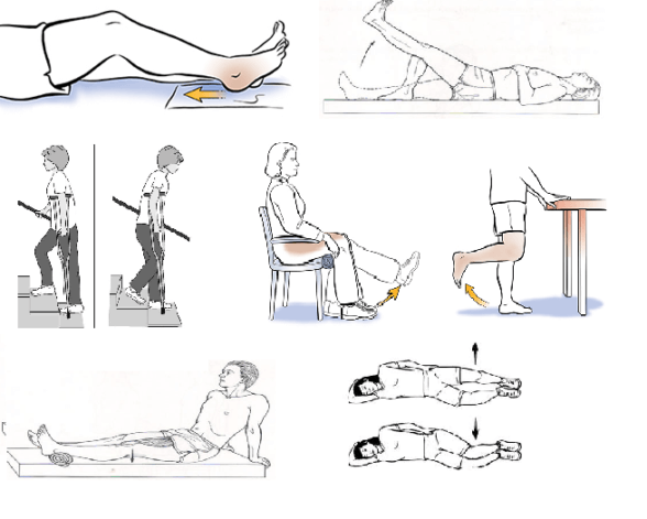 Exercises after knee replacement surgery