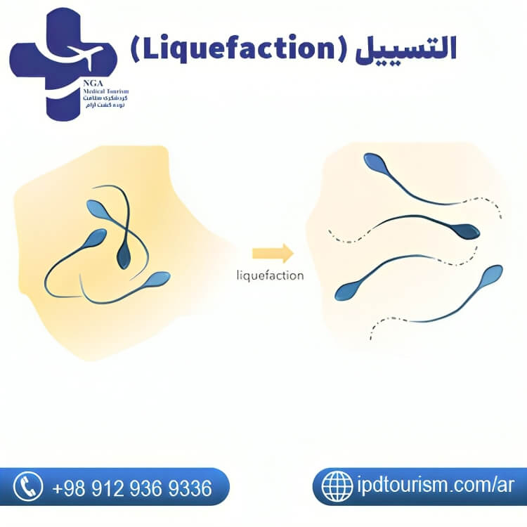 التسييل (Liquefaction)-5