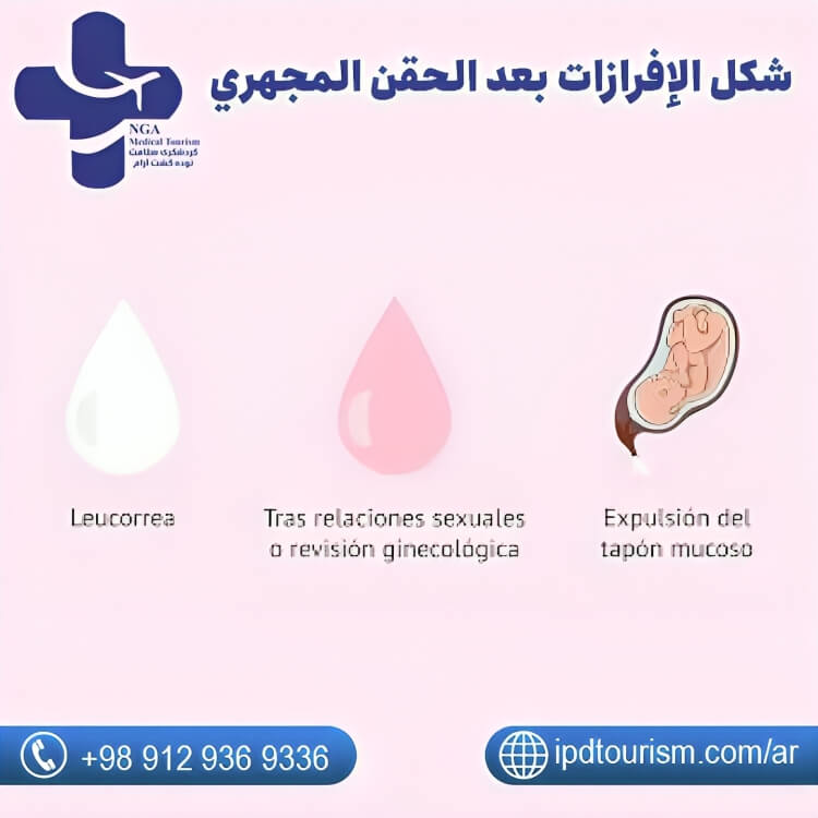 أعراض نجاح الحقن المجهري-23