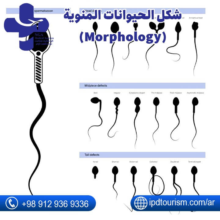 تحليل السائل المنوي للرجل-4