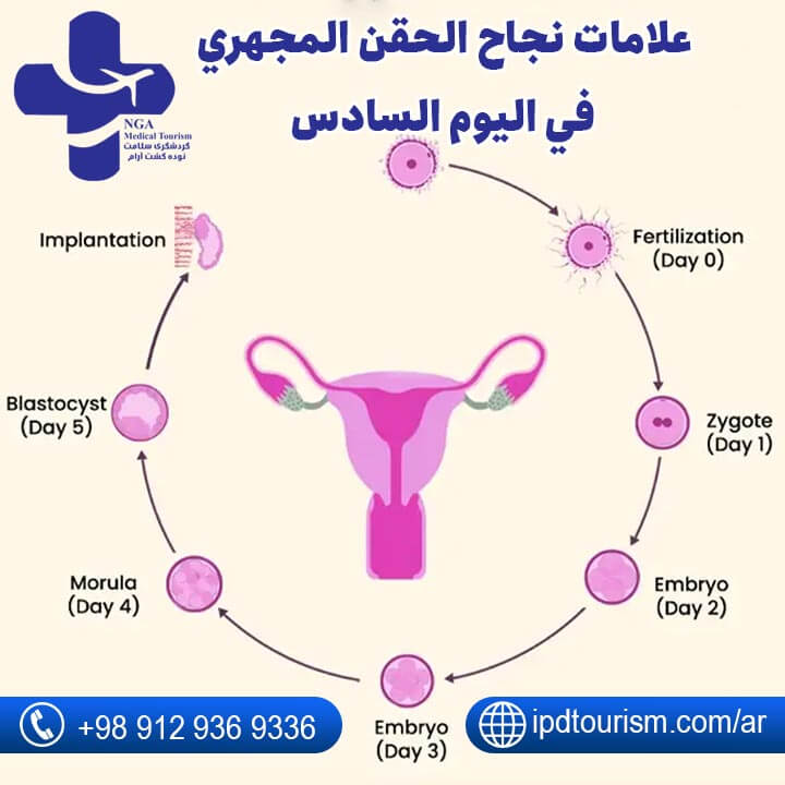أعراض نجاح الحقن المجهري-57
