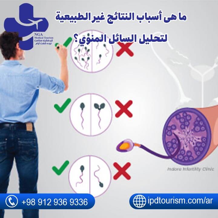 تحليل السائل المنوي للرجل-6