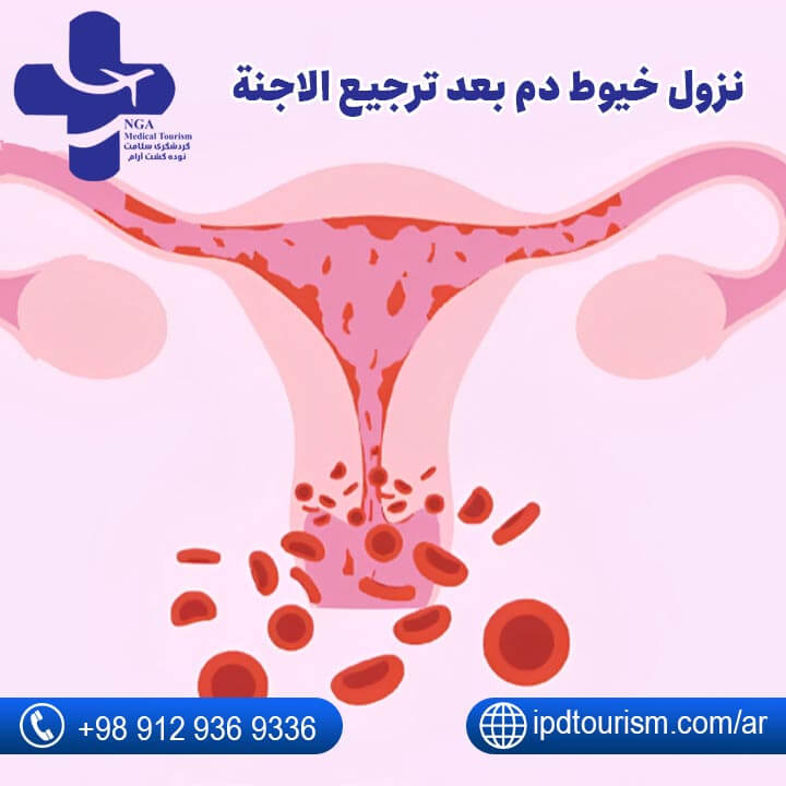 أعراض نجاح الحقن المجهري-22