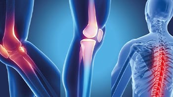 جراحة تقويم العظام في إيران