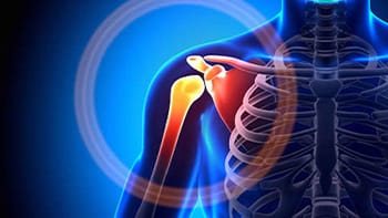 جراحة استبدال مفصل الكتف فی ایران