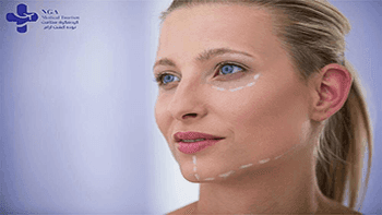 جراحة بلاستيكية في إيران