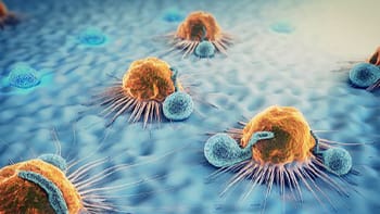 الأورام و السرطان و علاجه في الطب العربي الإسلامي