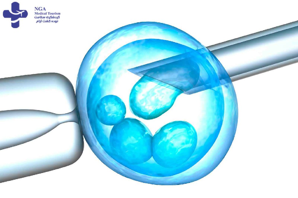 أفضل مستشفيات أطفال الأنابيب والعقم في إيران