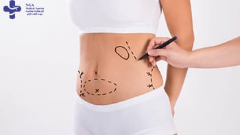 شفط الدهون في إيران