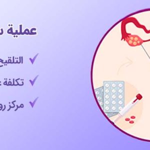عملية سحب البويضات-شاخص
