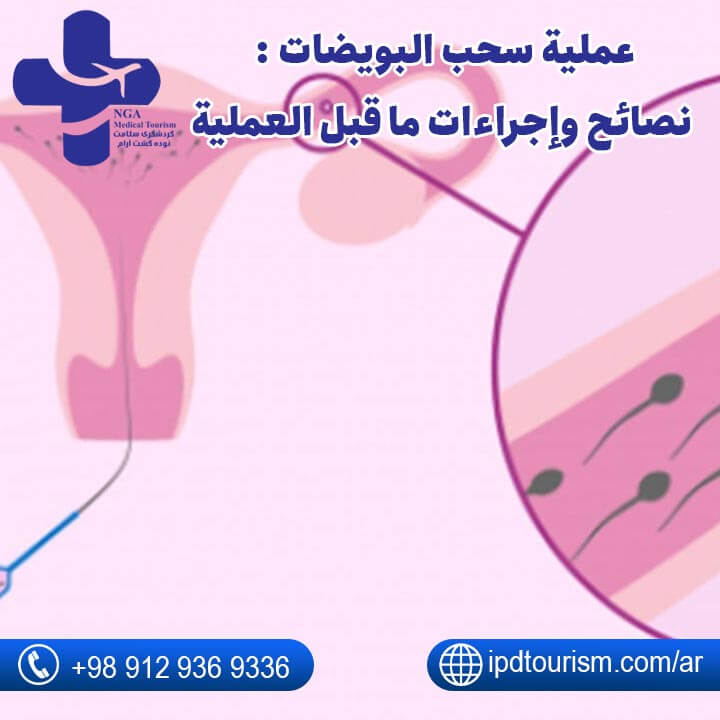 عملية سحب البويضات-1