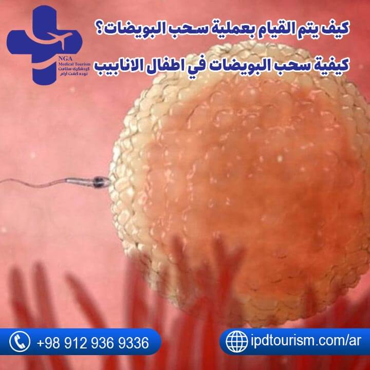 عملية سحب البويضات-6