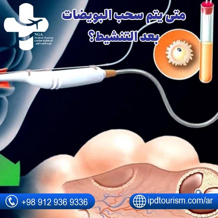 عملية سحب البويضات-2