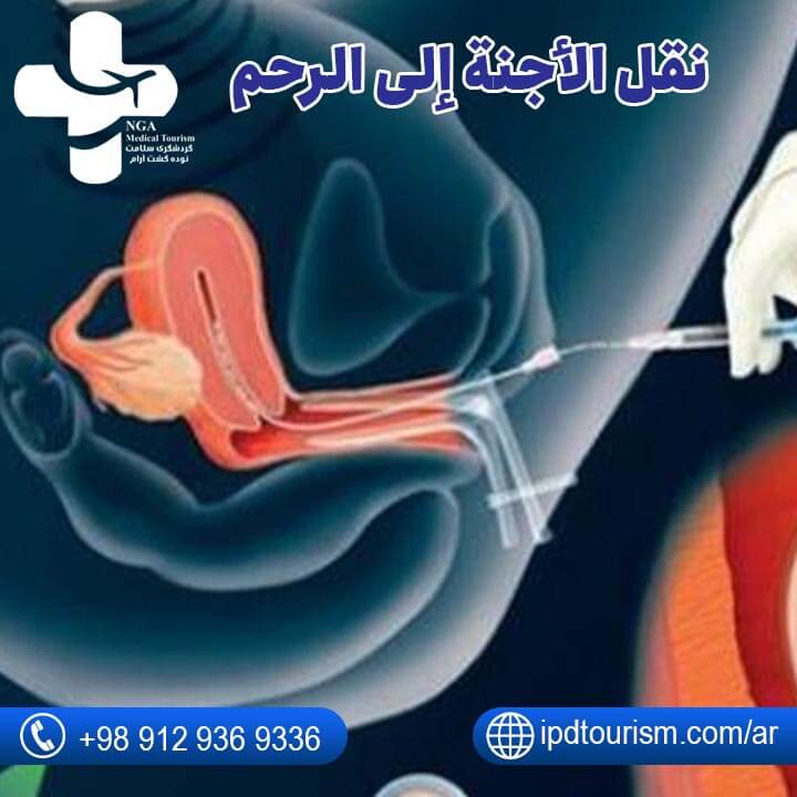 عملية سحب البويضات-9