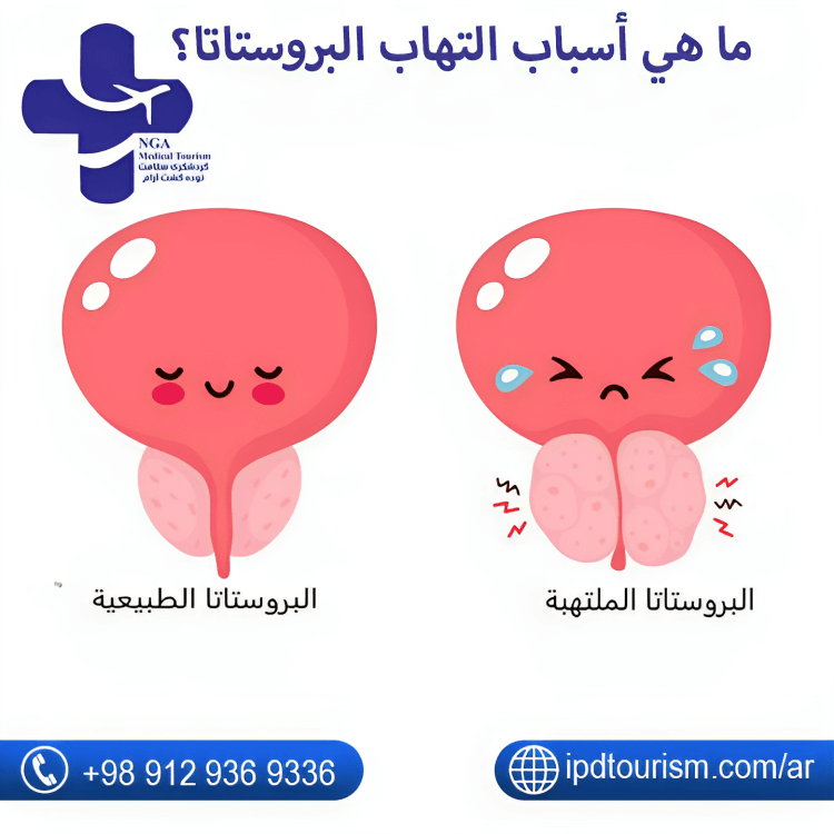 ما هي أسباب التهاب البروستاتا؟