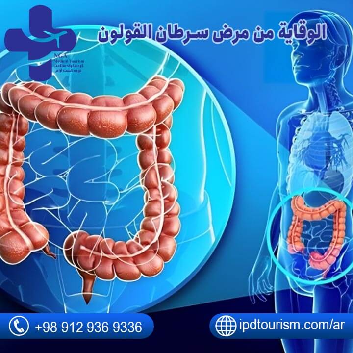 الوقاية من مرض سرطان القولون