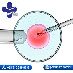 حقن الحيوان المنوي داخل الهَيولَى ICSI