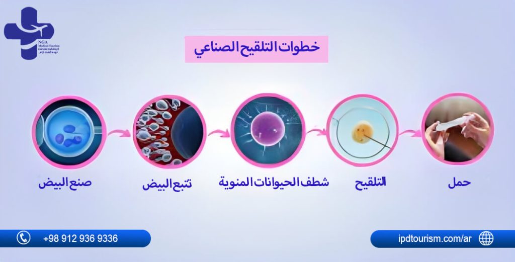 خطوات التلقيح الصناعي