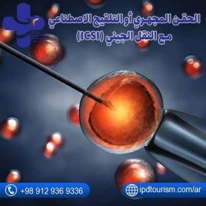 الحقن المجهري أو التلقيح الاصطناعي مع النقل الجيني (ICSI)