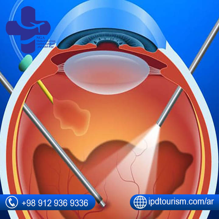 عمليات العيون في إيران-21