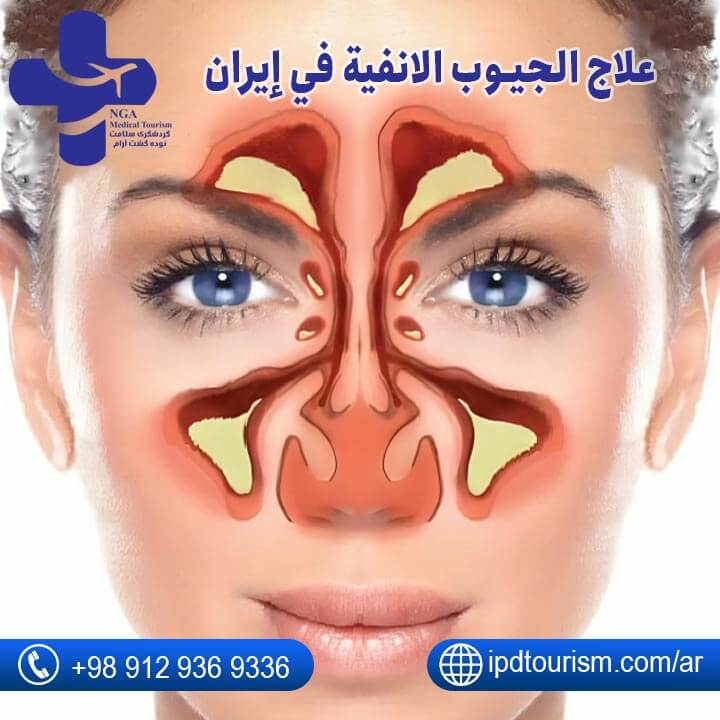 علاج الجيوب الانفية-2