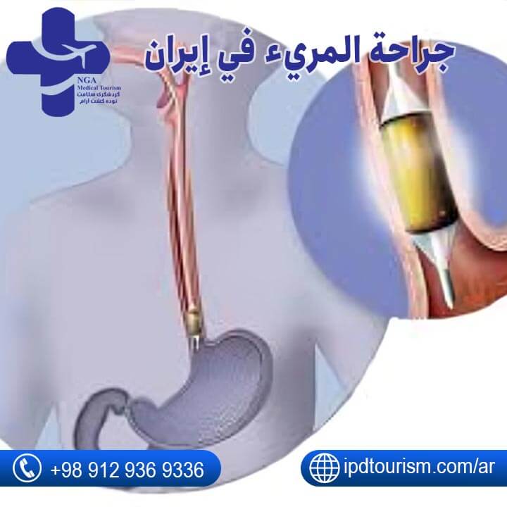 جراحة المريء-2