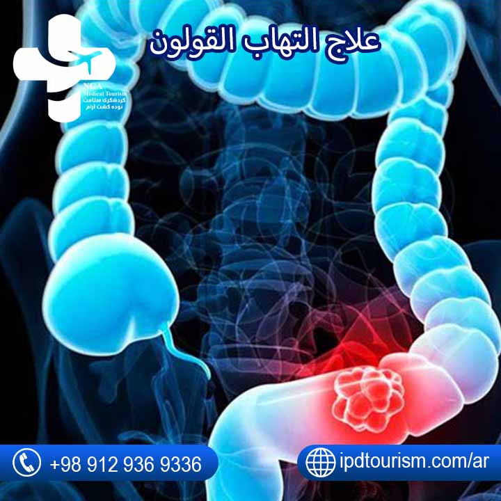 علاج القولون-8