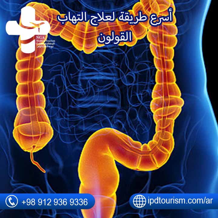 علاج القولون-9