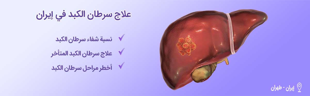 علاج سرطان الكبد-شاخص