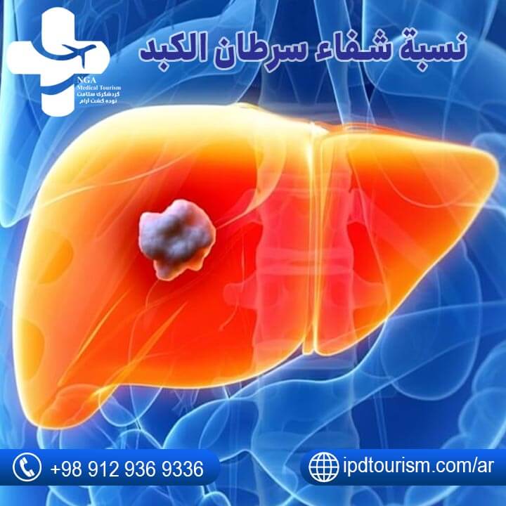 علاج سرطان الكبد-1