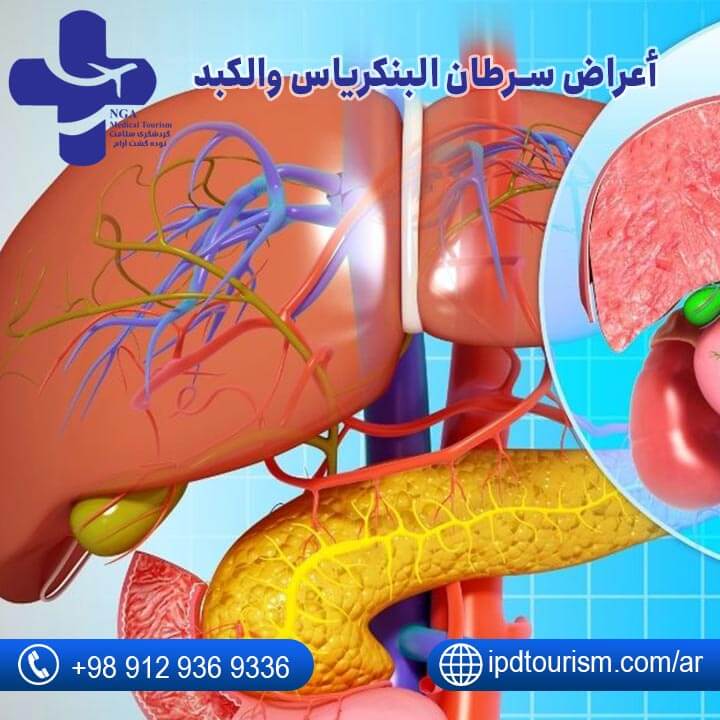 سرطان البنكرياس-2