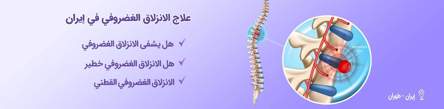 الانزلاق الغضروفي-شاخص