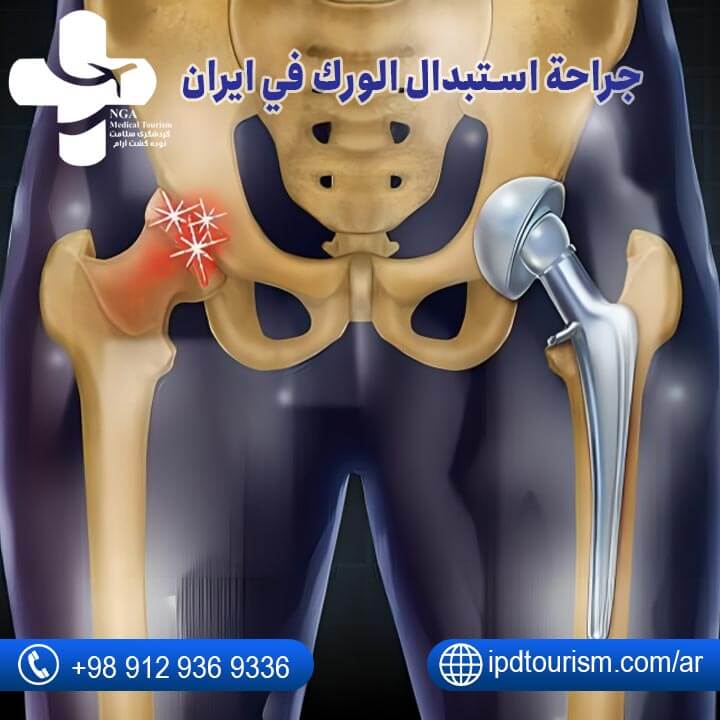 علاج المفاصل-1