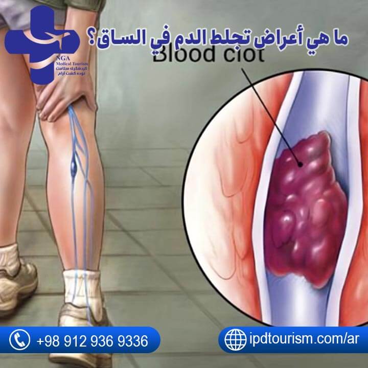 سرطان البنكرياس-3