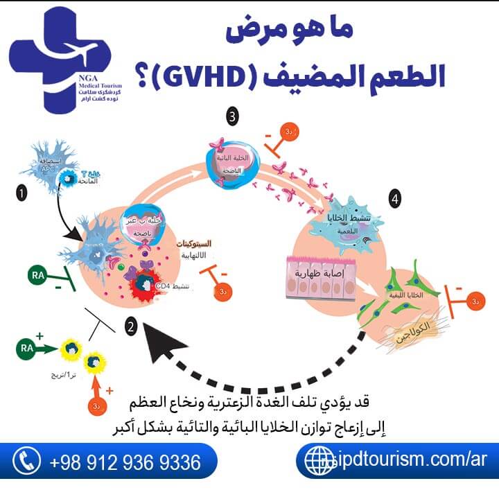 تكلفة عملية زراعة نخاع العظم في ايران | زراعة النخاع العظمي في ايران-5