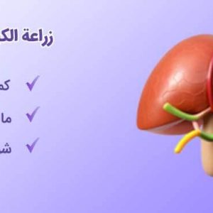 زراعة الكبد للجزائریین-شاخص