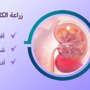 زراعة الكلي للجزائريين-شاخص