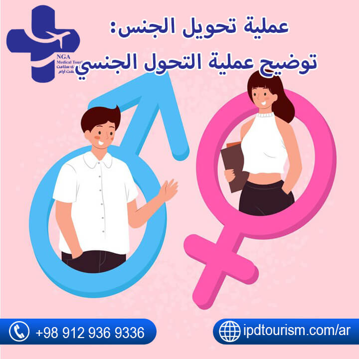 عملية تحويل الجنس
