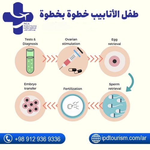 نسبة نجاح أطفال الأنابيب في سن الأربعين-6