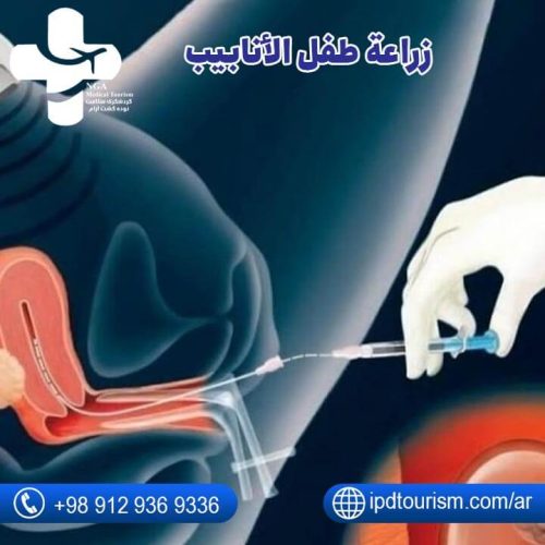 نسبة نجاح أطفال الأنابيب في سن الأربعين-7