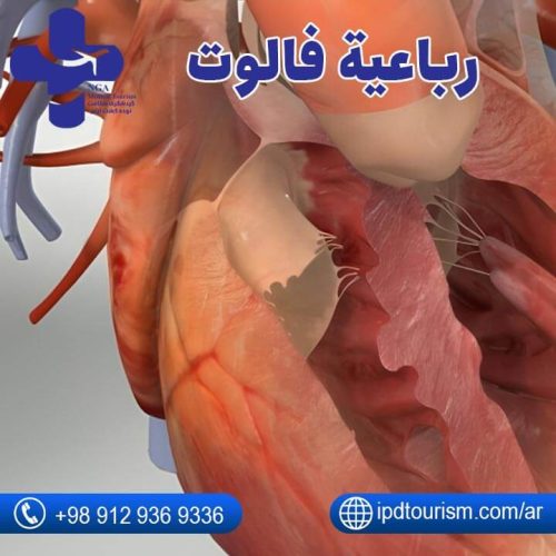 جراحة القلب للأطفال العمانيين-4