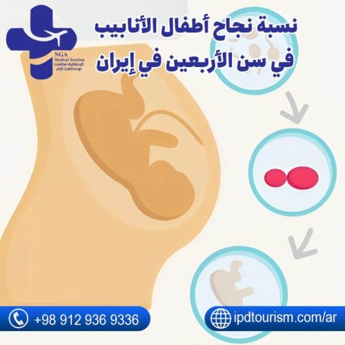 نسبة نجاح أطفال الأنابيب في سن الأربعين-1