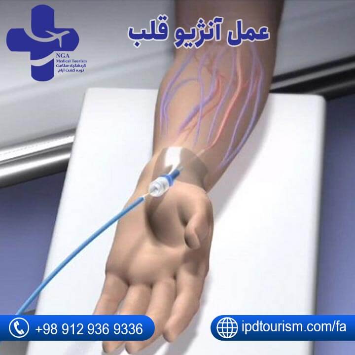 عمل قلب-2