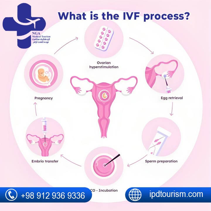 What is the IVF process?