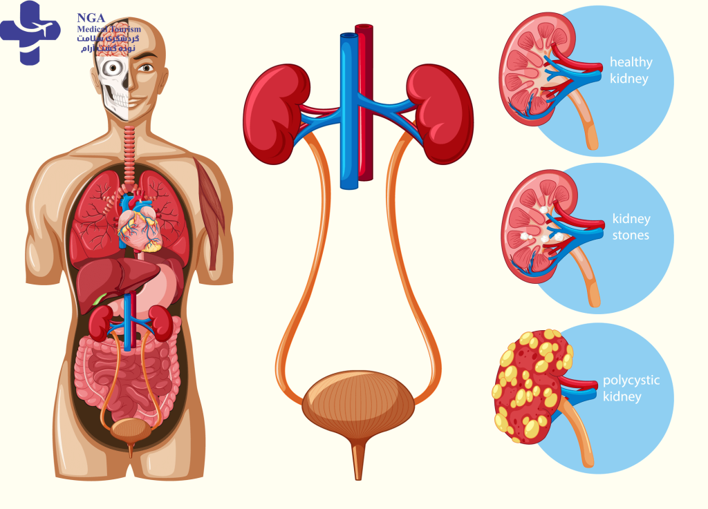 Differences Between Urology and Nephrology