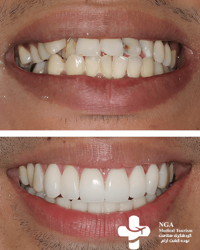 cosmetic dentistry before and after 3