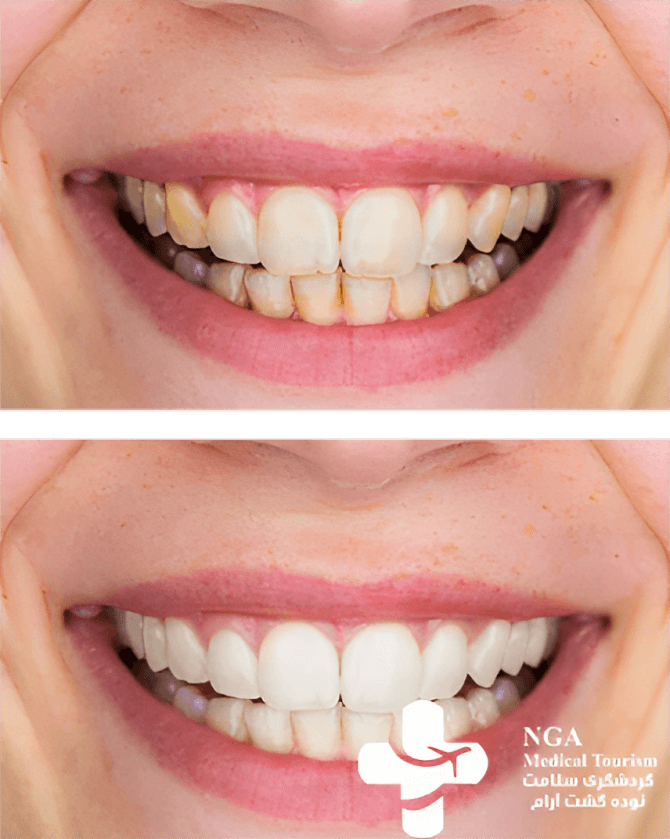 cosmetic dentistry before and after 1